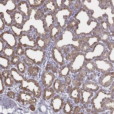 Immunohistochemistry-Paraffin: Xanthine Oxidase Antibody [NBP2-57577]