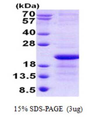 SDS-PAGE: Recombinant Human Xg His Protein [NBP2-22952]
