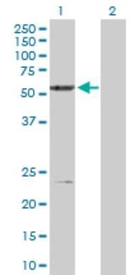 Western Blot: Xrn1 Antibody [H00054464-D01P]