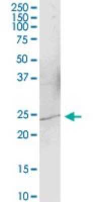 Western Blot: YAF2 Antibody [H00010138-B01P]