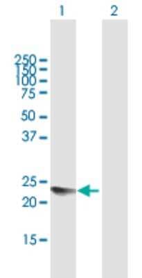 Western Blot: YAF2 Antibody [H00010138-B01P]