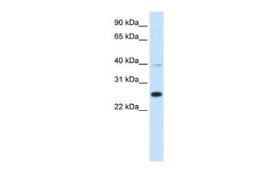 Western Blot: YAF2 Antibody [NBP3-10432]