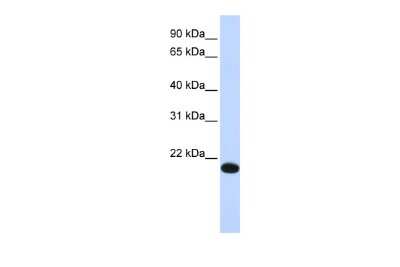 Western Blot: YAF2 Antibody [NBP3-10953]