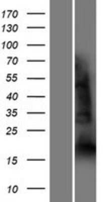 Western Blot: YAF2 Overexpression Lysate [NBP2-07711]