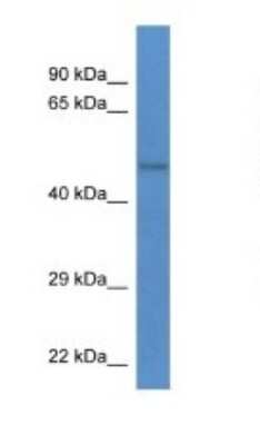 Western Blot: YANK2 Antibody [NBP1-74225]