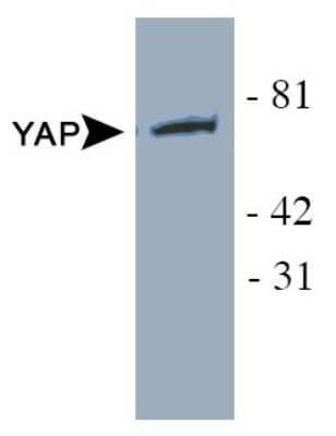 Western Blot: YAP1 AntibodyBSA Free [NB110-58358]
