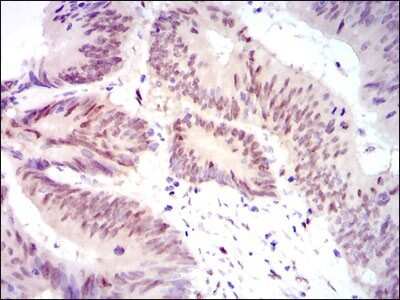 Immunohistochemistry: YAP1 Antibody (1A12) - Azide and BSA Free [NBP2-81014]