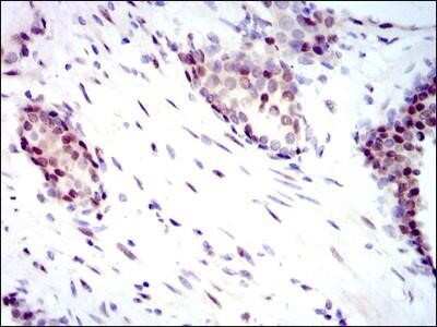 Immunohistochemistry-Paraffin: YAP1 Antibody (1A12) - Azide and BSA Free [NBP2-81014]