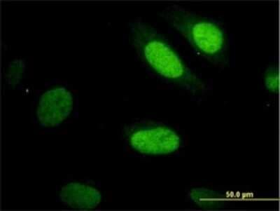 Immunocytochemistry/ Immunofluorescence: YAP1 Antibody (2F12) - Isoform 5 [H00010413-M01]