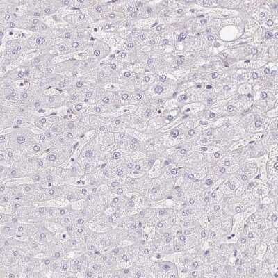 Immunohistochemistry-Paraffin: YAP1 Antibody [NBP2-38430]