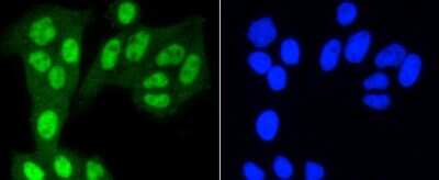 Immunocytochemistry/ Immunofluorescence: YAP1 Antibody (SU33-06) [NBP2-67467]