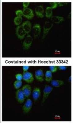 Immunocytochemistry/ Immunofluorescence: YARS Antibody [NBP1-32551]
