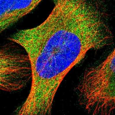 Immunocytochemistry/ Immunofluorescence: YARS Antibody [NBP1-86889]