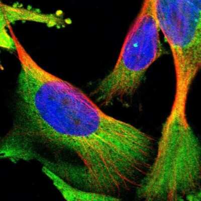 Immunocytochemistry/ Immunofluorescence: YARS Antibody [NBP1-86890]