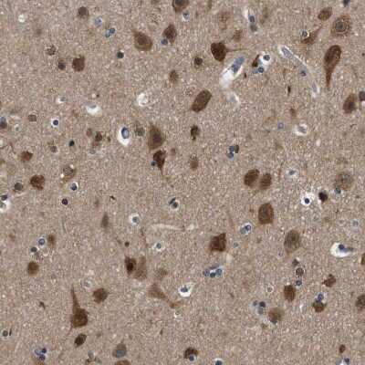 Immunohistochemistry-Paraffin: YARS Antibody [NBP1-86889]