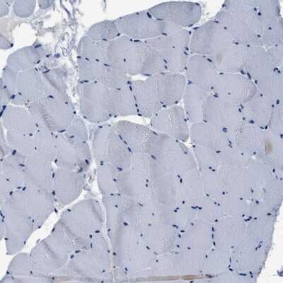 Immunohistochemistry-Paraffin: YARS Antibody [NBP1-86889]