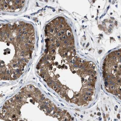 Immunohistochemistry-Paraffin: YARS Antibody [NBP1-86889]