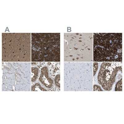 Immunohistochemistry-Paraffin: YARS Antibody [NBP1-86891]