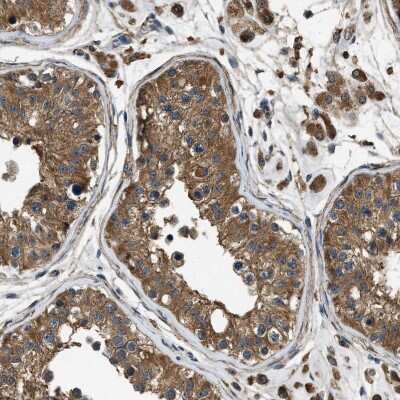Immunohistochemistry-Paraffin: YARS Antibody [NBP1-86891]