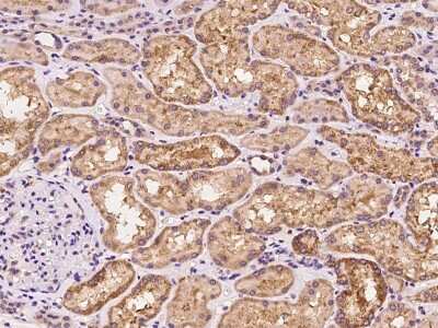 Immunohistochemistry-Paraffin: YARS Antibody [NBP2-98605]