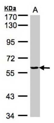 Western Blot: YARS Antibody [NBP1-32551]