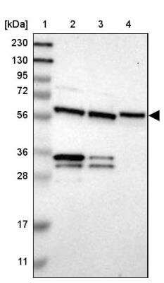 Western Blot: YARS Antibody [NBP1-86891]