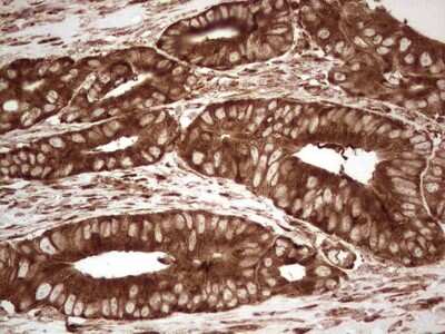 Immunohistochemistry: YB1 Antibody (OTI7B4) [NBP2-46381]