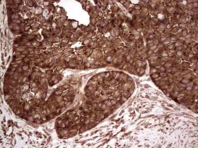 Immunohistochemistry: YB1 Antibody (OTI7B4) [NBP2-46381]