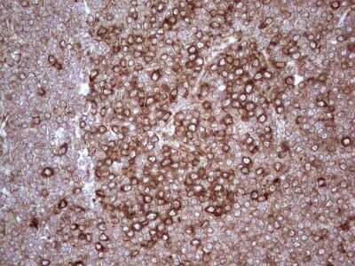 Immunohistochemistry: YB1 Antibody (OTI7B4) [NBP2-46381]