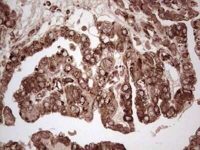 Immunohistochemistry: YB1 Antibody (OTI7B4) - Azide and BSA Free [NBP2-74905]