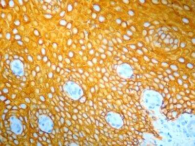 Immunohistochemistry-Paraffin: YELLOW HRP Staining Kit (Colorimetric) [NBP3-12184]