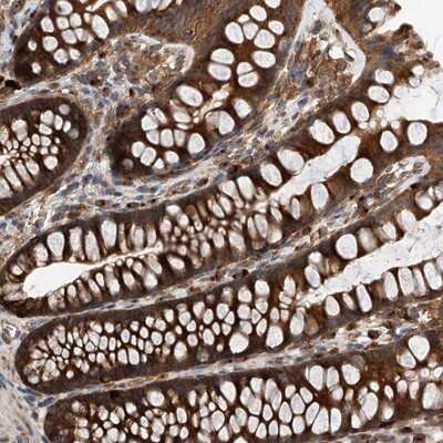 Immunohistochemistry-Paraffin: YF5 Antibody [NBP1-89338]