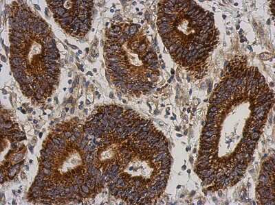 Immunohistochemistry-Paraffin: YF5 Antibody [NBP2-21571]