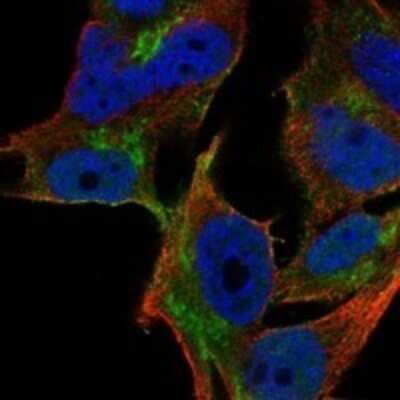 Immunocytochemistry/ Immunofluorescence: YIPF1 Antibody [NBP3-17560]