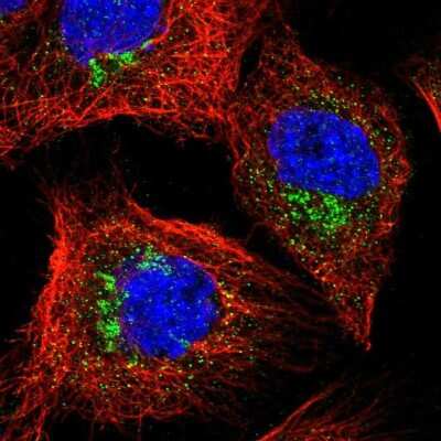 Immunocytochemistry/ Immunofluorescence: YIPF3 Antibody [NBP1-86765]