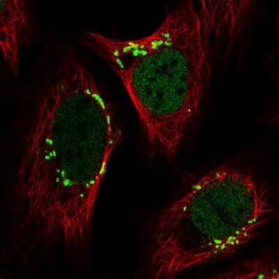 Immunocytochemistry/ Immunofluorescence: YIPF3 Antibody [NBP2-56181]