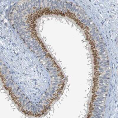 Immunohistochemistry-Paraffin: YIPF3 Antibody [NBP1-86765]