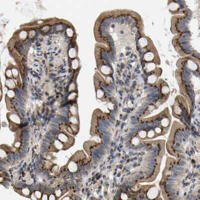 Immunohistochemistry-Paraffin: YIPF4 Antibody [NBP1-84684]