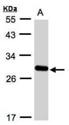 Western Blot: YIPF4 Antibody [NBP1-32497]