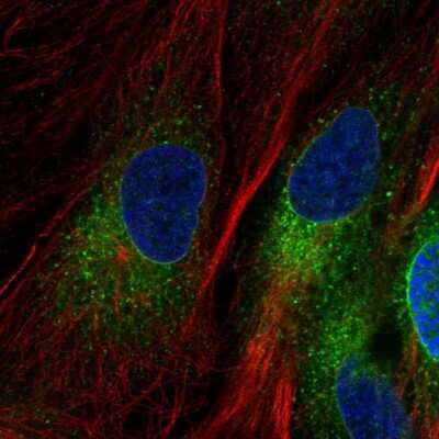 Immunocytochemistry/ Immunofluorescence: YIPF5 Antibody [NBP2-57970]