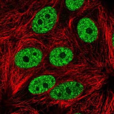 Immunocytochemistry/ Immunofluorescence: YLPM1 Antibody [NBP2-56737]