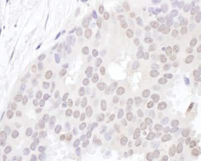Immunohistochemistry-Paraffin: YLPM1 Antibody [NBP2-22326]