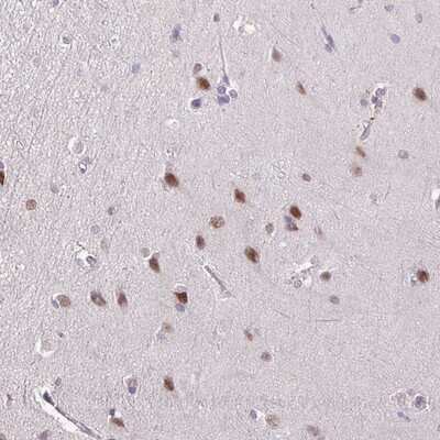 Immunohistochemistry-Paraffin: YLPM1 Antibody [NBP2-14628]