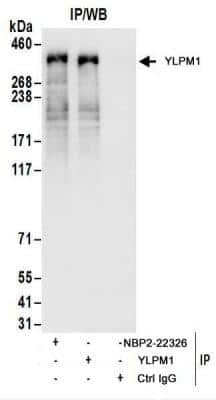 Immunoprecipitation: YLPM1 Antibody [NBP2-22326]