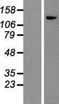 Western Blot: YME1L1 Overexpression Lysate [NBP2-07363]