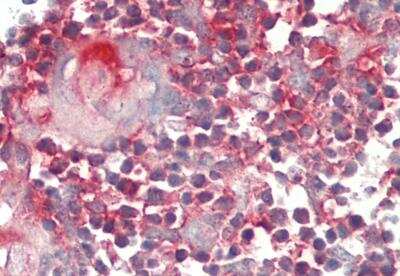 Immunohistochemistry: YRDC Antibody [NBP2-83779]