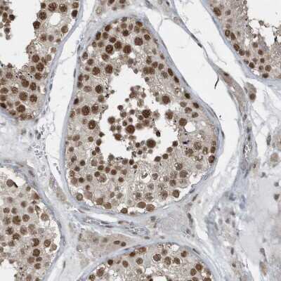 Immunohistochemistry-Paraffin: YTHDC1 Antibody [NBP1-81353]