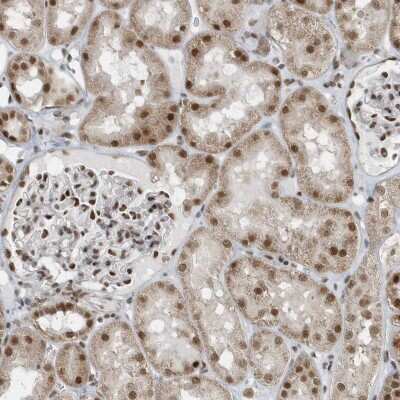 Immunohistochemistry-Paraffin: YTHDC1 Antibody [NBP1-81353]