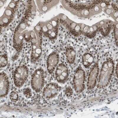 Immunohistochemistry-Paraffin: YTHDC1 Antibody [NBP1-81353]