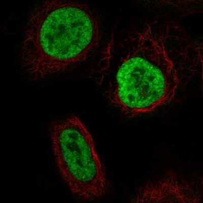 Immunocytochemistry/ Immunofluorescence: YTHDC2 Antibody [NBP2-57606]